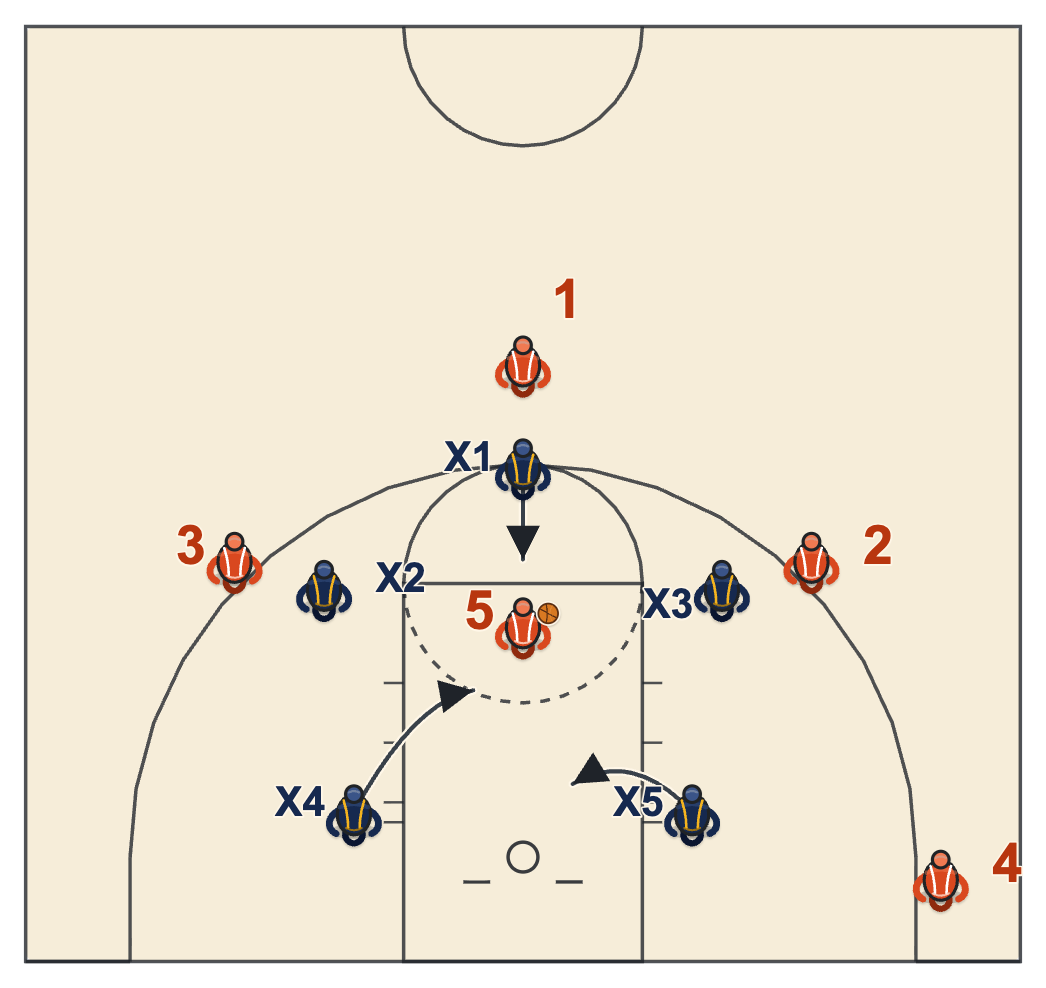 1-2-2 zone defense rotation with the ball at the high post, one big stepping up and the other sliding to the middle of the lane