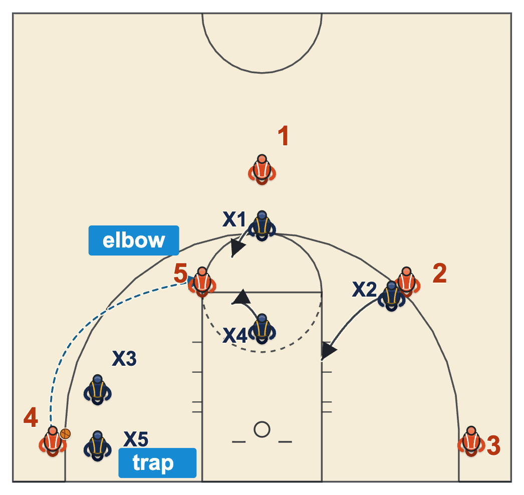 1-3-1 zone: the escape pass to the elbow