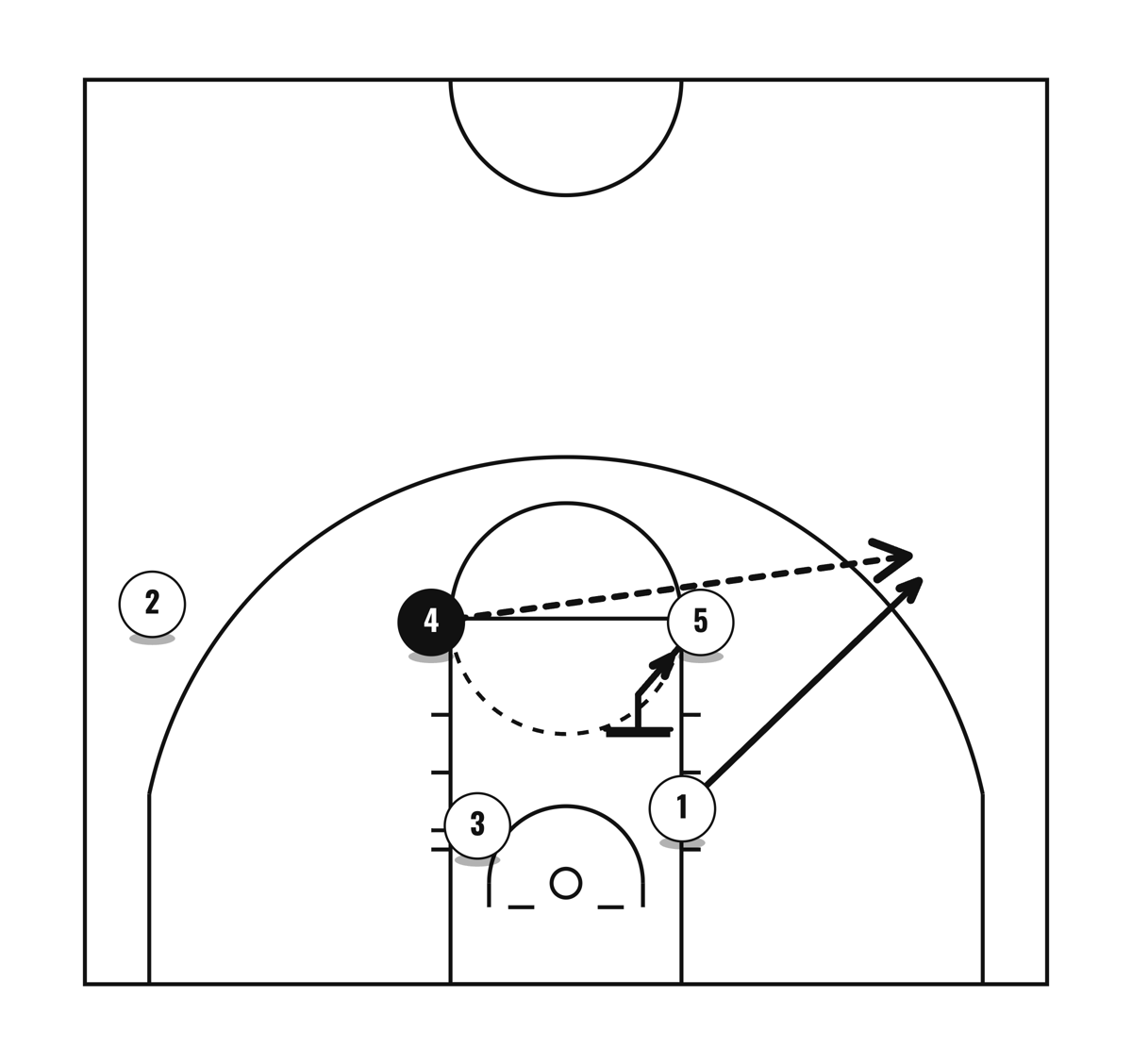 Elbow Middle, diagram 2 of 3