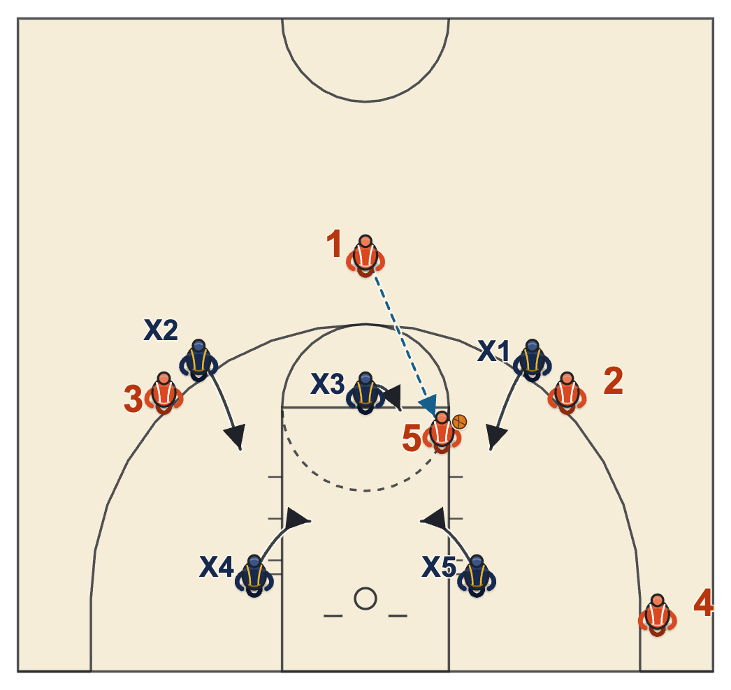 3-2 zone: ball enters the high post
