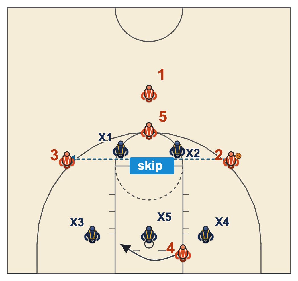 Blocker-Mover offense in a Top-Bottom alignment against a 2-3 zone with a skip pass and the bottom Blocker sealing low