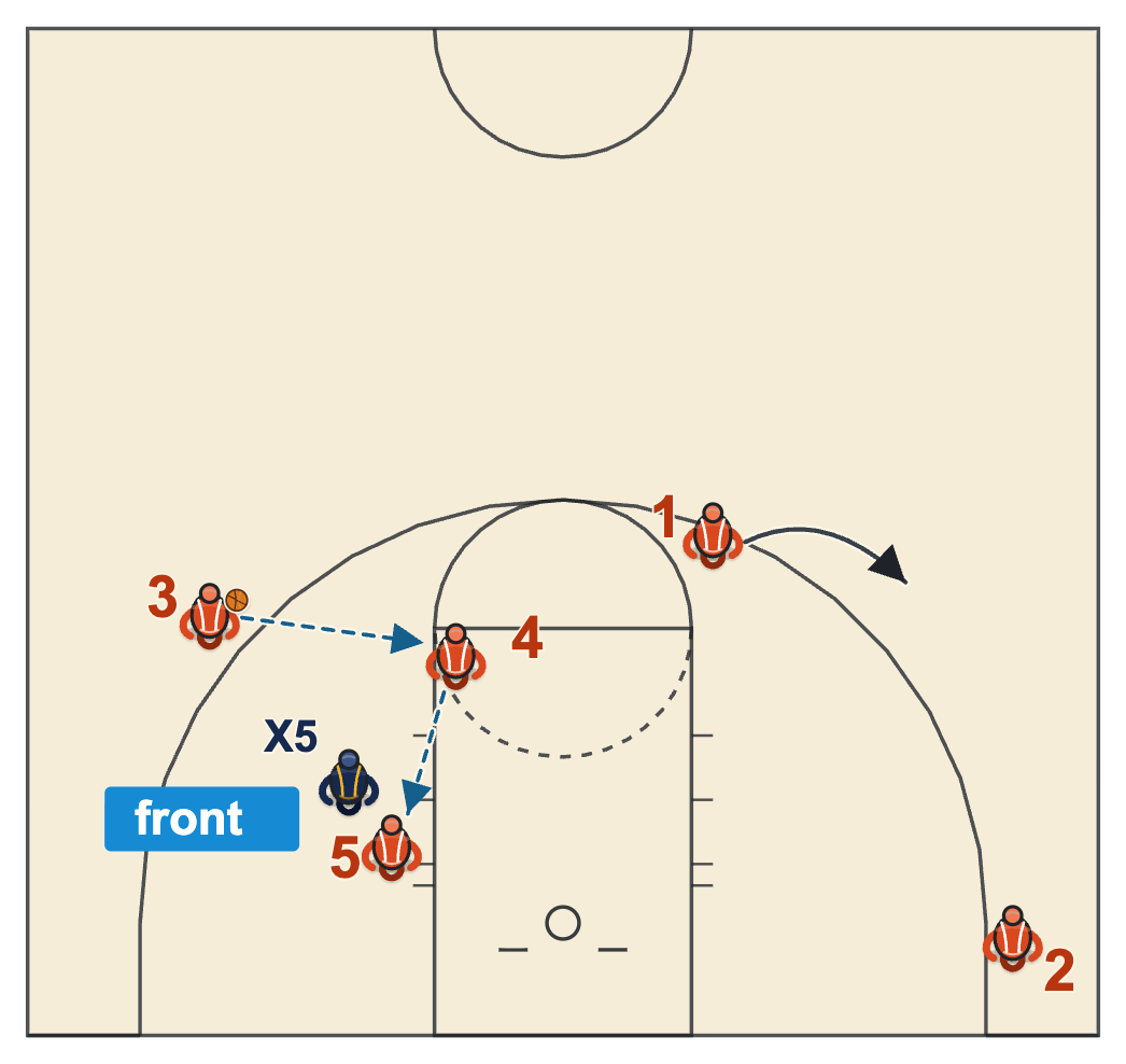 Early offense basketball hi-lo flash to the elbow when the post is fronted