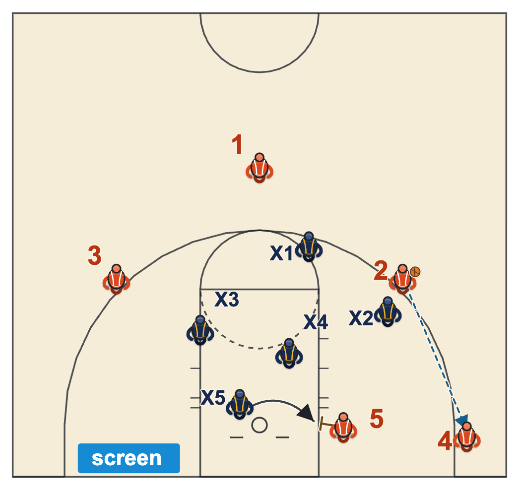 1-3-1 zone diagram with the low post screening the baseline defender as he sprints to the corner
