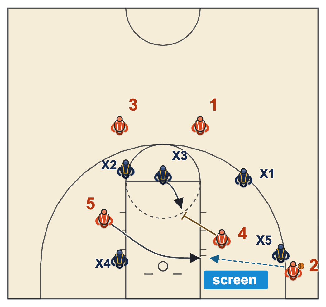 How to beat a 3-2 zone defense by screening the middle defender when he slides down to the block