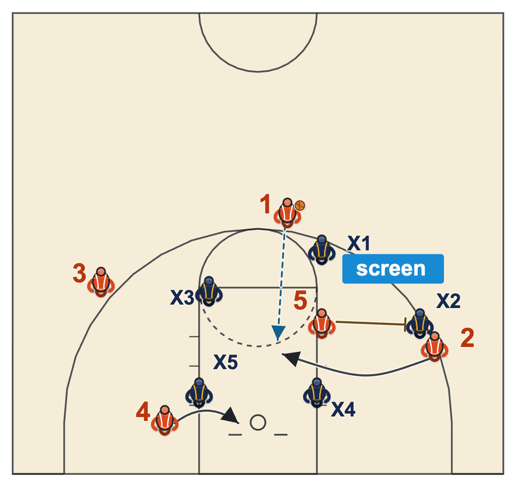 How to beat a box and 1 defense with a big along the lane screening the chaser so the star cuts into the middle