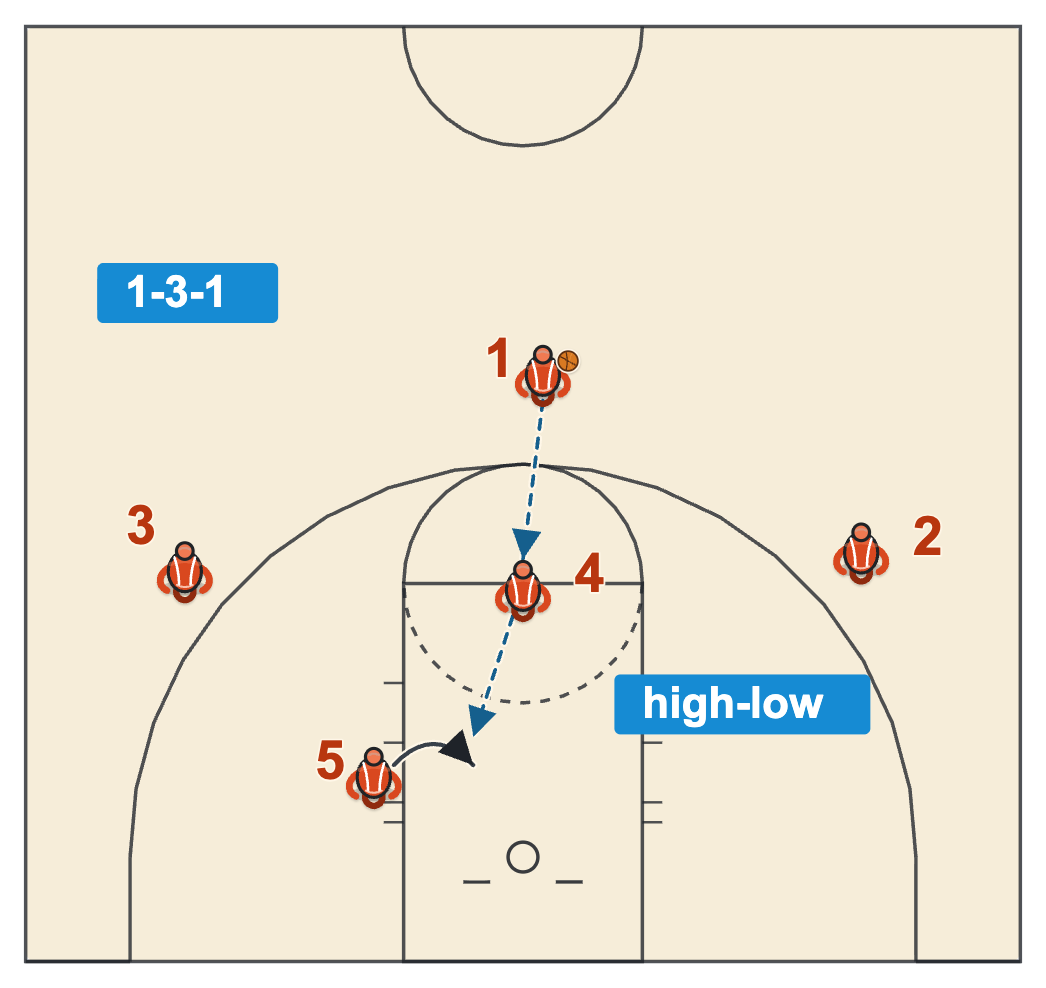 UCLA high-low offense in a 1-3-1 look with the high post feeding the low post who ducks in from the left block