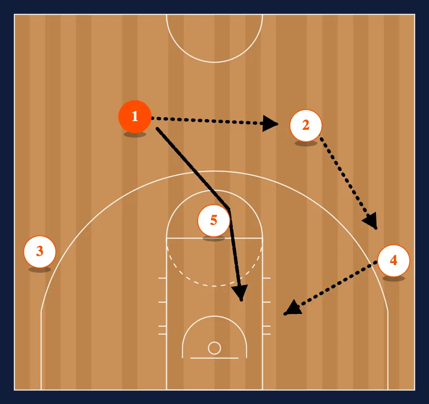 The Chin Set - Option 1 diagram