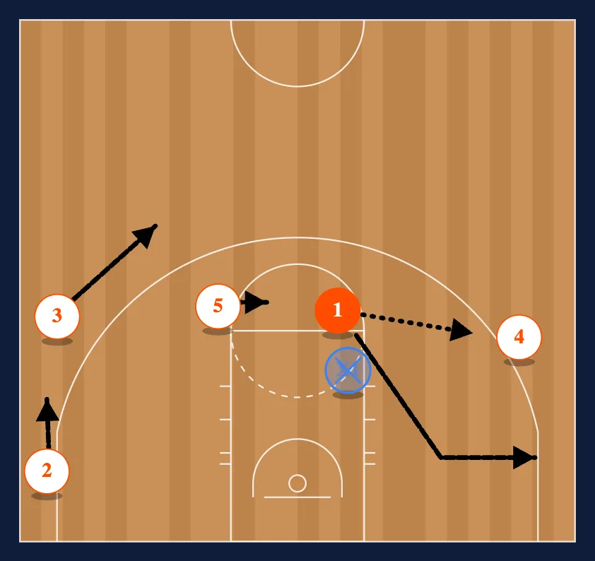 The Chin Set - Option 3 diagram