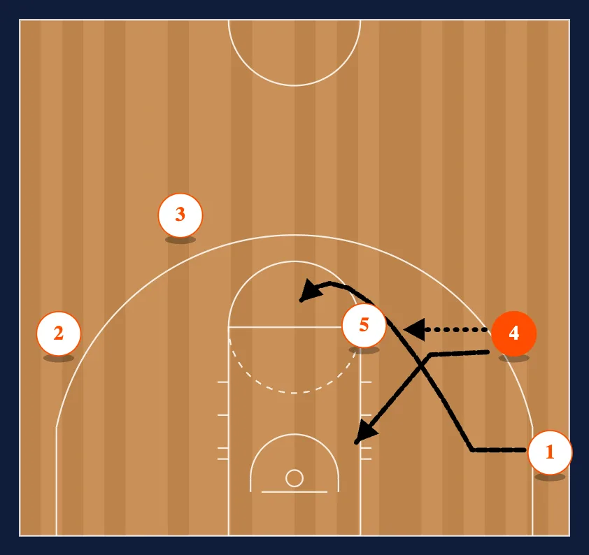 The Chin Set - Option 3 step 2
