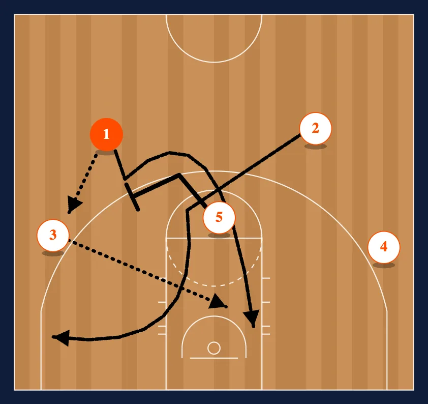 The Chin Set - Option 4 diagram