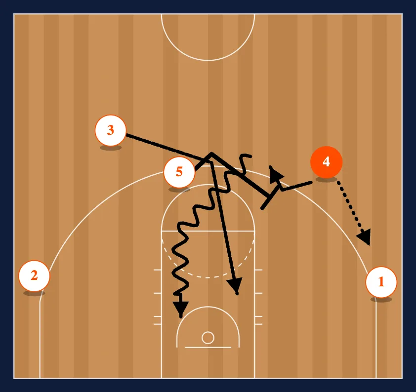 The Chin Set - Option 4 step 3