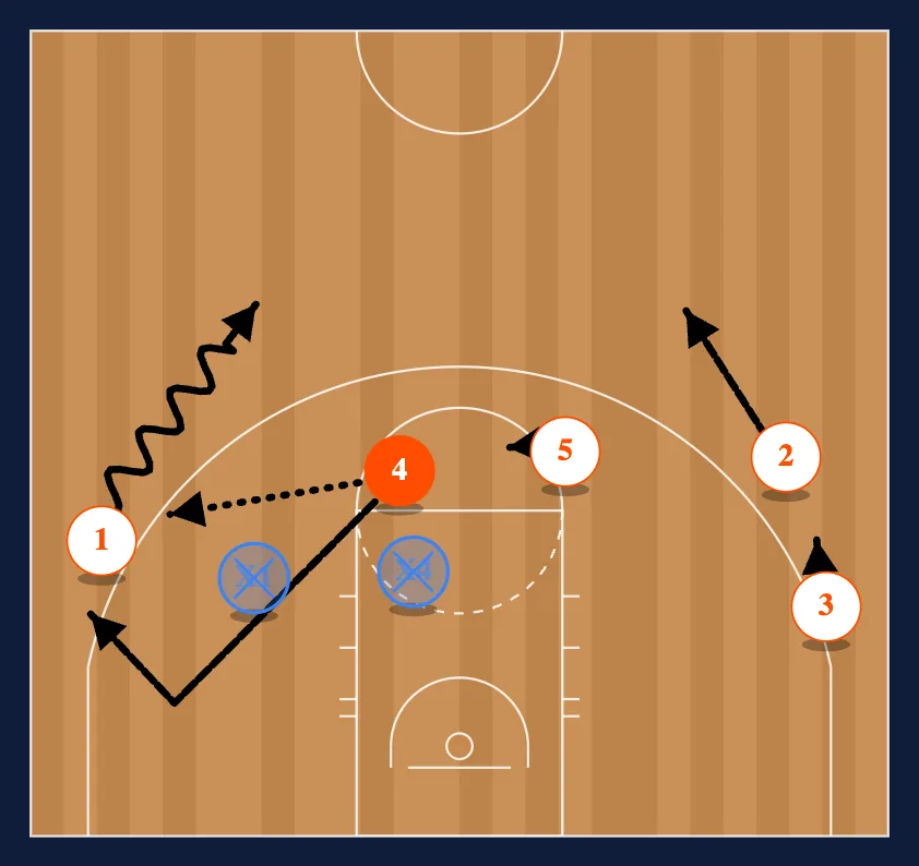 The Chin Set step 4